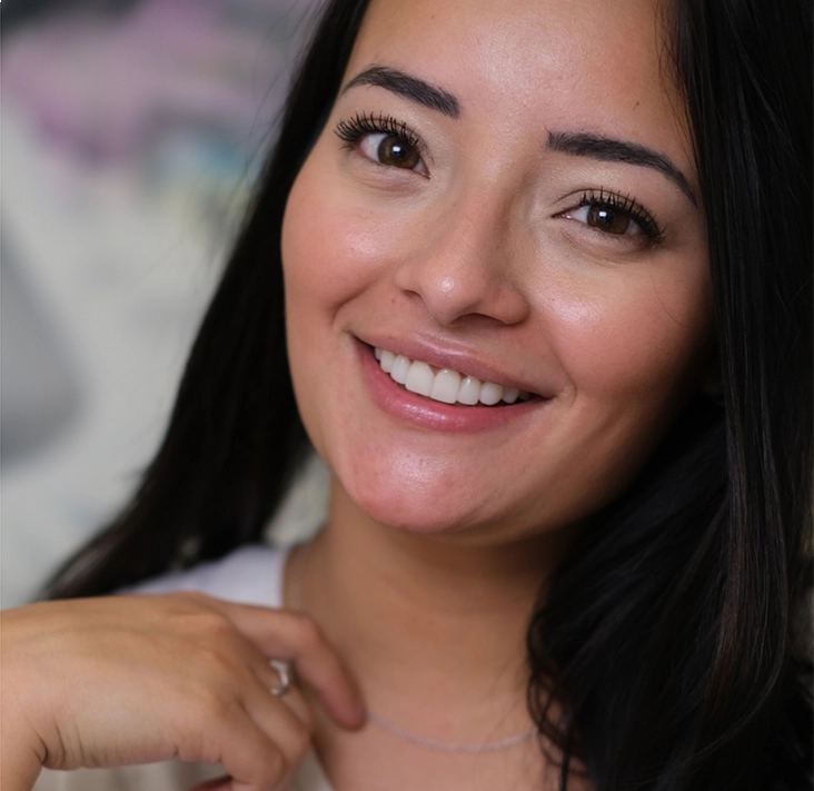 ¿Cómo conseguir una buena sonrisa para el día de tu boda?