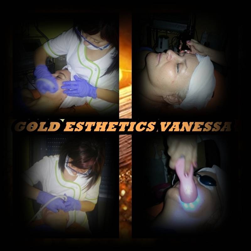 Gold Esthetics Vanessa